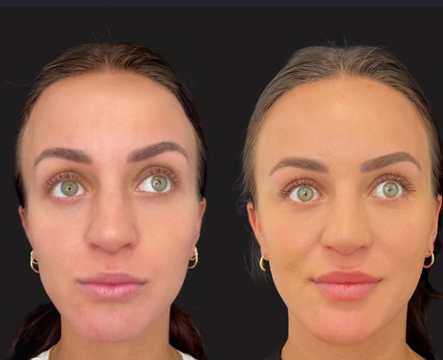 Facial balancing consultation
